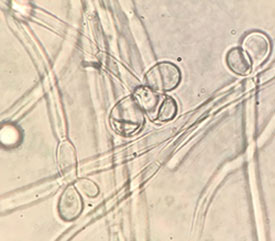ambrosia monospora cell