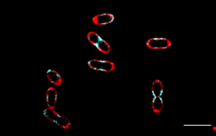 rhodobacter sphaeroides