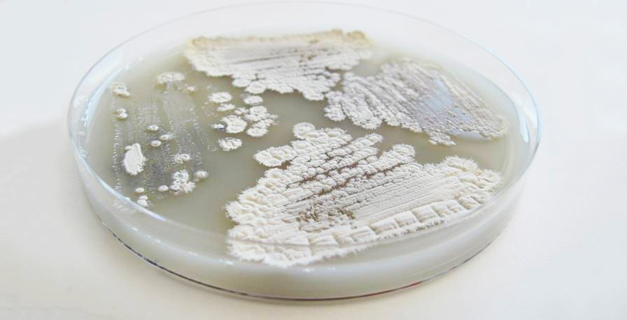 Streptomyces