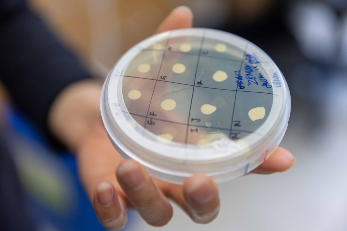 A petri dish with multiple yellow spots