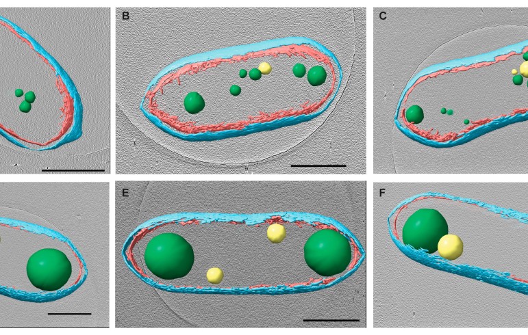 Cells are depicted in six panels with cell components tinted for clarity: cell walls are cyan and magenta. PHB granules are green and PP granules yellow. The top row of untreated cells have multiple small PHB and PP granules while the bottom row of treated cells have only one or two much larger granules arranged at the extremeties of the cell.