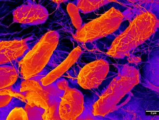 Microbiome bacteria