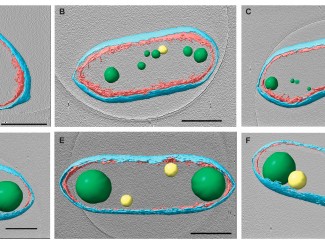 Cells are depicted in six panels with cell components tinted for clarity: cell walls are cyan and magenta. PHB granules are green and PP granules yellow. The top row of untreated cells have multiple small PHB and PP granules while the bottom row of treated cells have only one or two much larger granules arranged at the extremeties of the cell.