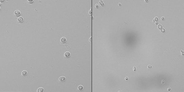 Microscope images of Saccharomyces cerevisiae yeast cells